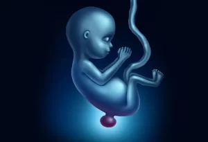 اختلالات لوله عصبی یا NTDs