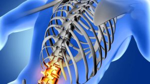 جراحی دیسککتومی چیست؟