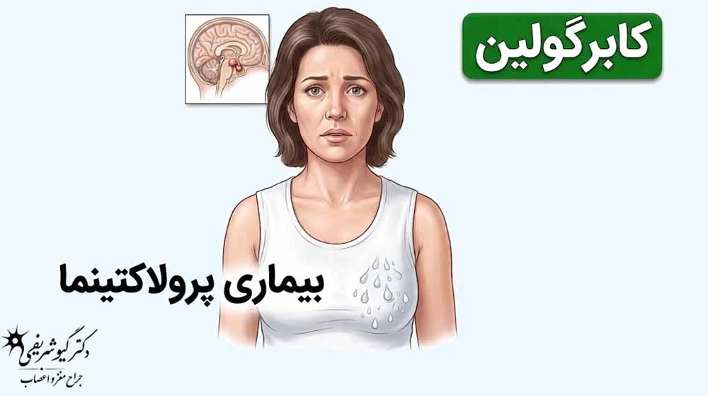 درمانهای غیرجراحی تومور هیپوفیز؛ چه زمانی میتوان بدون جراحی درمان کرد؟ 6 پرولاکتین