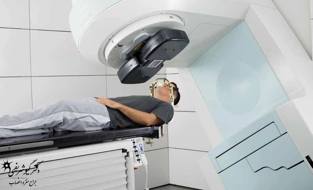 درمانهای غیرجراحی تومور هیپوفیز؛ چه زمانی میتوان بدون جراحی درمان کرد؟ 10 پرتودرمانی