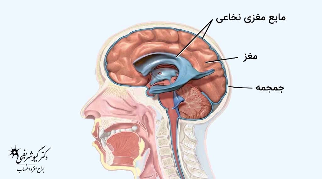 مراقبتهای بعد از جراحی هیپوفیز از راه بینی؛ اشتباهات رایج از هفته اول تا ماهها 8 مایع مغزینخاعی