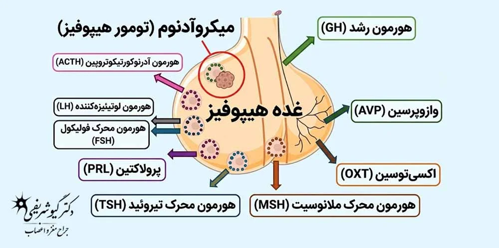 میکروآدنوم عملکردی