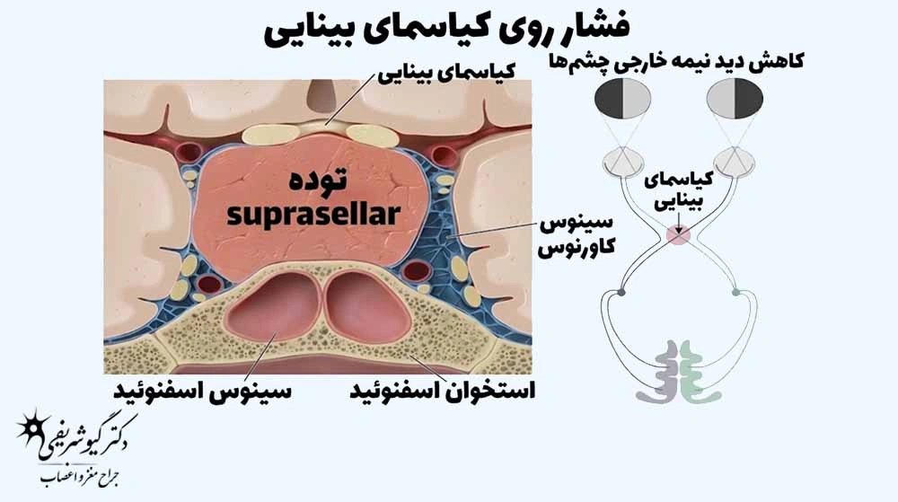 گزارش MRI