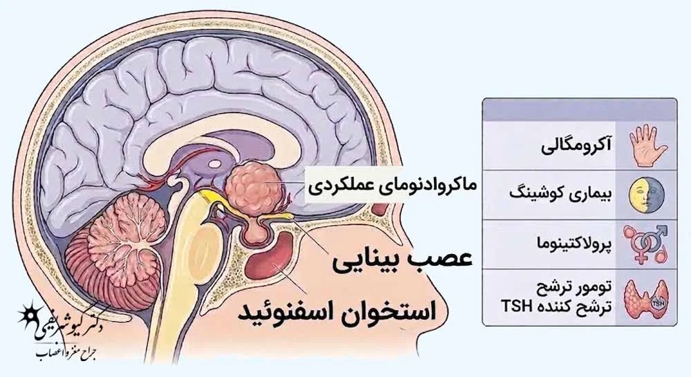 ماکرو