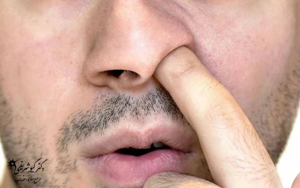 دستکاری بینی
