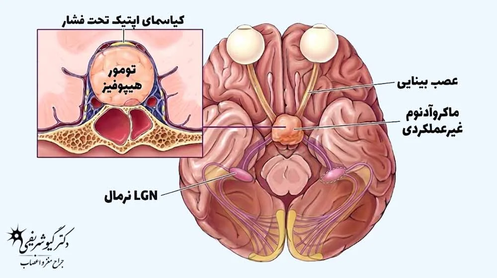 عصب بینایی