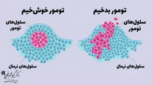 جراحی هیپوفیز