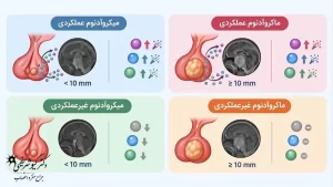 تومور هیپوفیز
