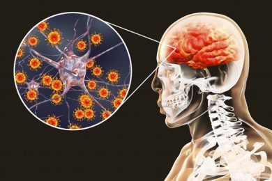 Meningoencephalitis