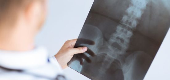 Surgery-