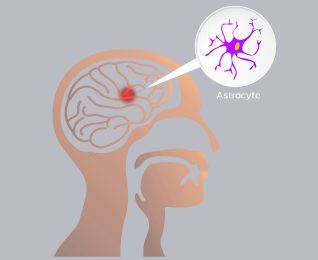 آستروسیتوم
