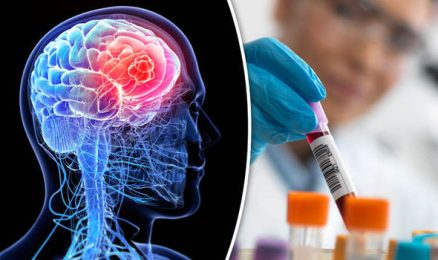 Screening of Brain Tumors