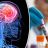 Screening of Brain Tumors