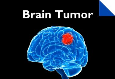 brain-tumor-health-hub