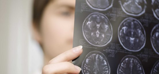 brain-tumors