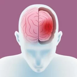 cerebral-atrophy-1-300x300