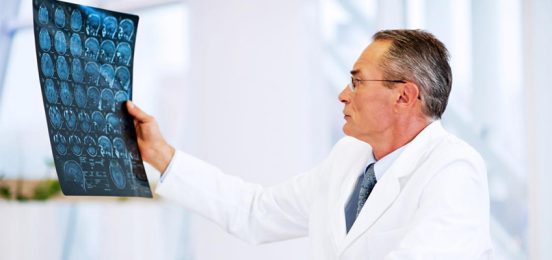 doctor-looking-at-brain-mri-scans
