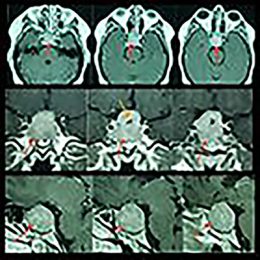 tomor